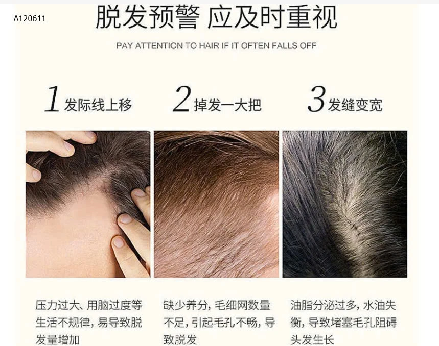 XỊT KÍCH THÍCH MỌC TÓC  ĐỒNG NHÂN ĐƯỜNG - sỉ 62k